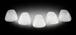 Recon Clear Cab Lights Ford 99-16 This Lens Only 264142CL. Fixed Price $73.53.